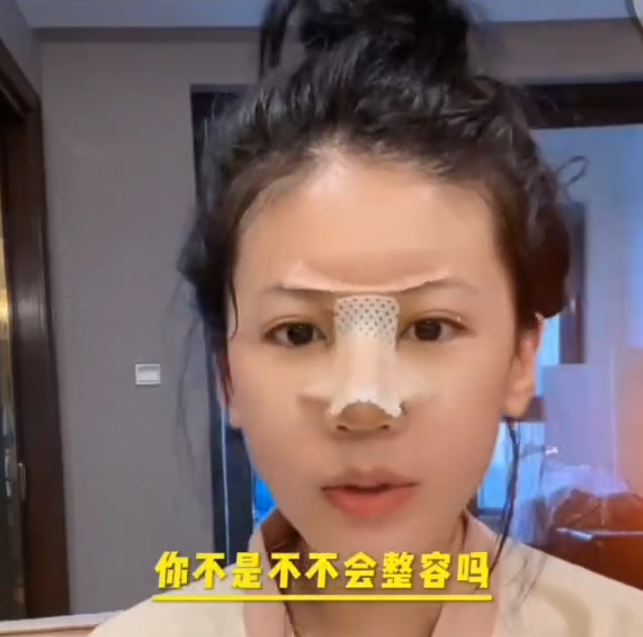 小炸串做完鼻子拆线,网友吐槽太丑了!宇文泡内涵某主播假想敌!(图4) 小炸串做完鼻子拆线,网友吐槽太丑了!宇文泡内涵某主播假想敌!(图4)