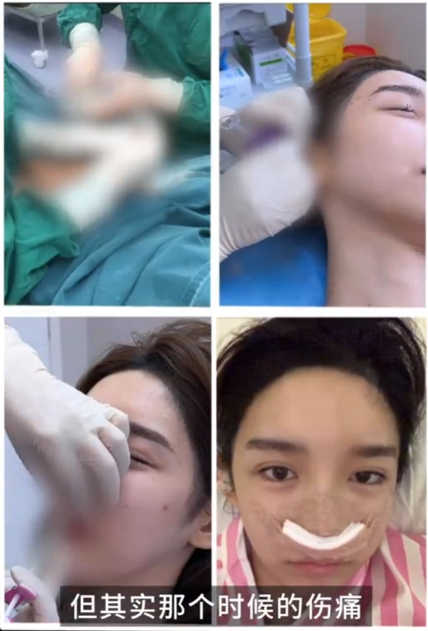 脸部前后60次“修改”，变性网红艾比分享整容经历，还是以前好看(图8)