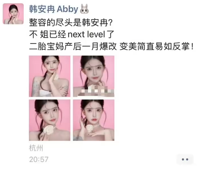 韩安冉产后一月就整容,大方晒出打针后的照片,整个脸都变形了(图2) 韩安冉产后一月就整容,大方晒出打针后的照片,整个脸都变形了(图2)