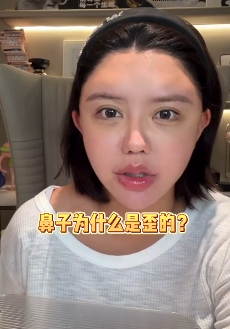 韩安冉产后一月就整容,大方晒出打针后的照片,整个脸都变形了(图4) 韩安冉产后一月就整容,大方晒出打针后的照片,整个脸都变形了(图4)
