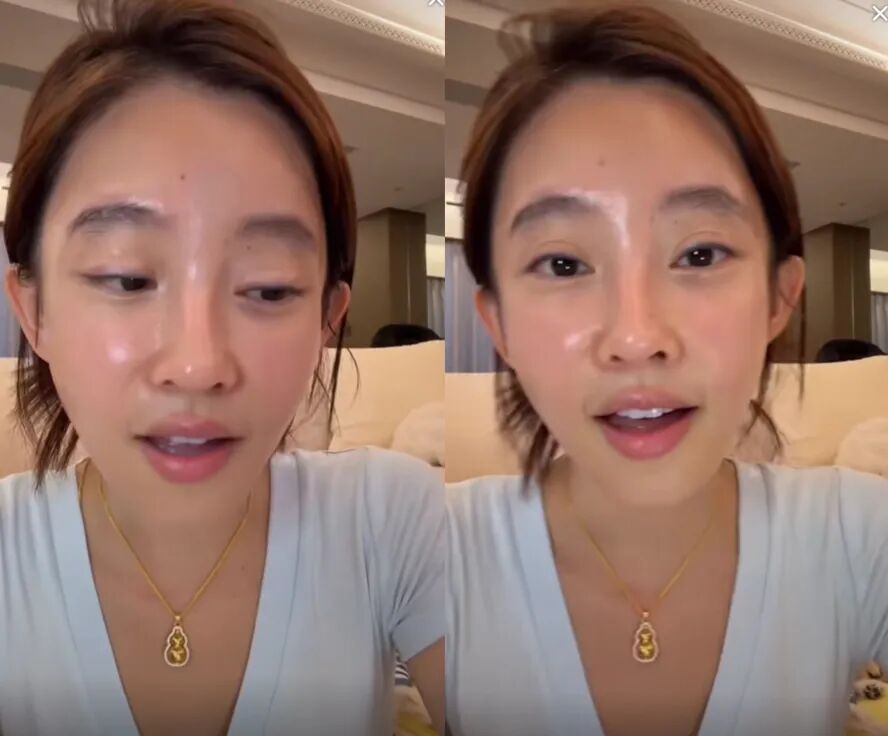 一毛钱的面膜敢用吗,我就敢!冯提莫讲述因捡便宜变成“激素脸”(图3) 一毛钱的面膜敢用吗,我就敢!冯提莫讲述因捡便宜变成“激素脸”(图3)