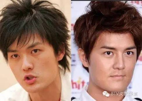 打死也不承认！那些娱乐圈整容到面瘫的男星(图10)