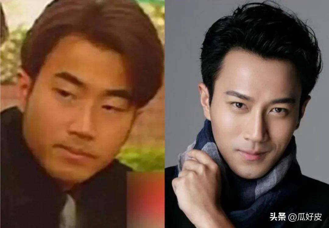 靠整容整得火出圈的5位男明星(图3) 靠整容整得火出圈的5位男明星(图3)