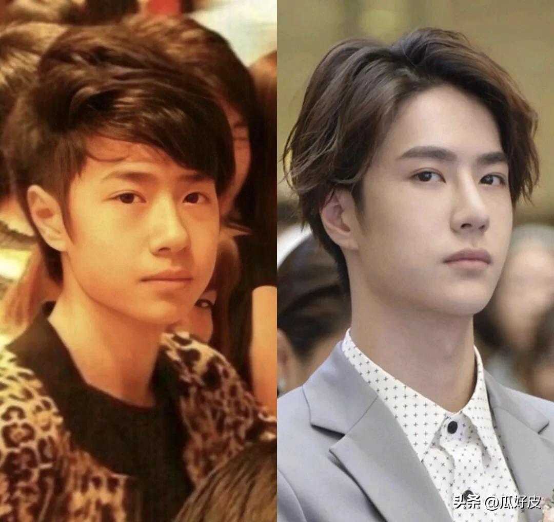 靠整容整得火出圈的5位男明星(图5) 靠整容整得火出圈的5位男明星(图5)