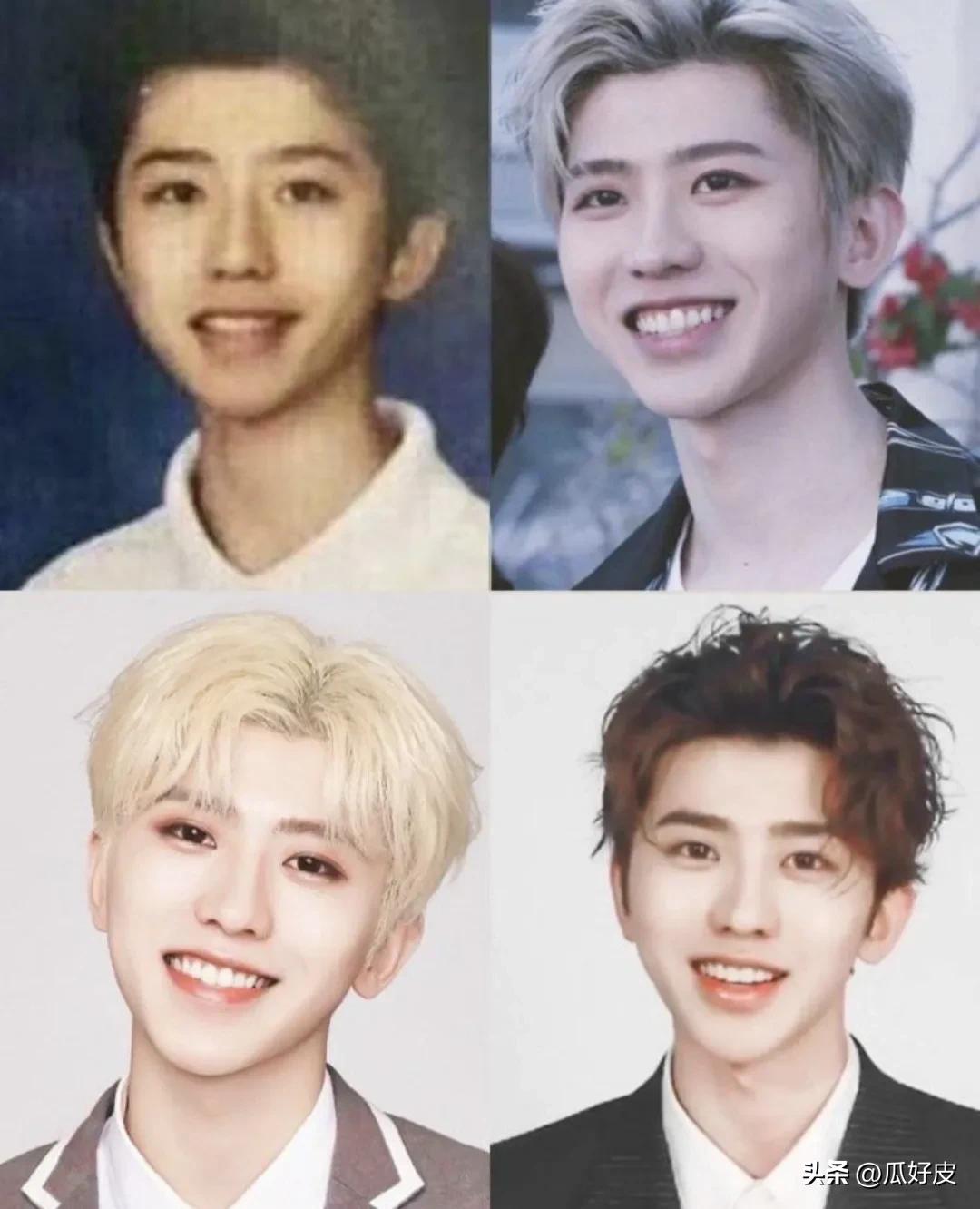 靠整容整得火出圈的5位男明星(图6) 靠整容整得火出圈的5位男明星(图6)