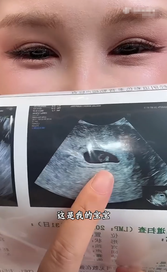 何婧婧自曝怀孕八周,刘一手发歌《爱你太多》,董莹莹回应“从此再无交集”?(图3) 何婧婧自曝怀孕八周,刘一手发歌《爱你太多》,董莹莹回应“从此再无交集”?(图3)